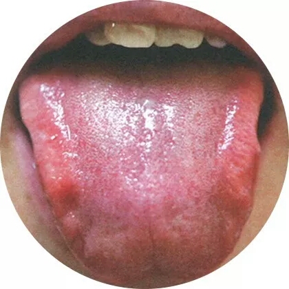 高清舌诊图谱,看舌头知健康