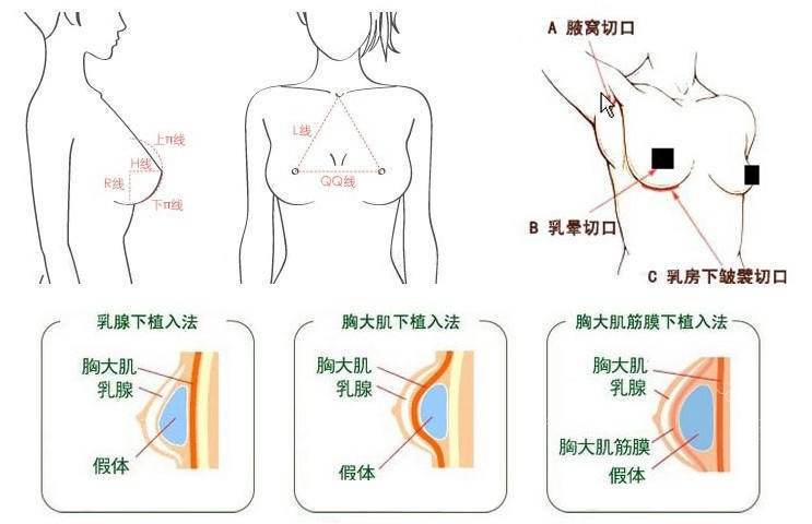 1,全身状况不能够耐受乳房美容整形手术者;      2,患者有严重的